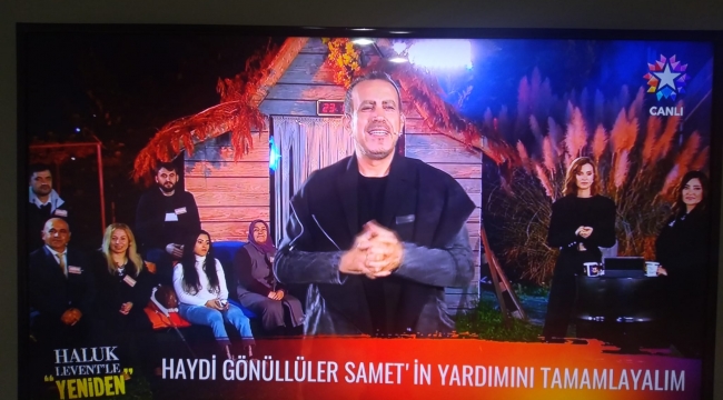 Samet, protez kollarına kavuşuyor