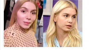 Aleyna Tilki'ye estetik eleştirisi! 