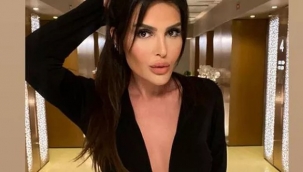 Selin Ciğerci dolgularını eritti!